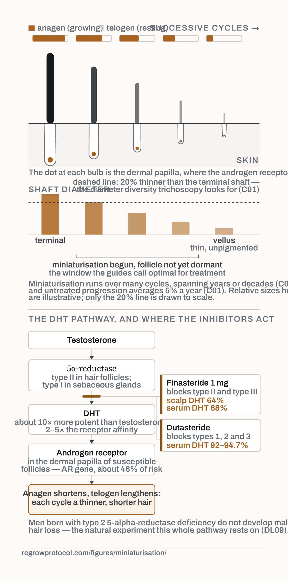 How a follicle miniaturises. The same follicle over successive cycles under DHT: a shorter growing phase each time, and a shaft that comes back finer, shorter and less pigmented until it is vellus.